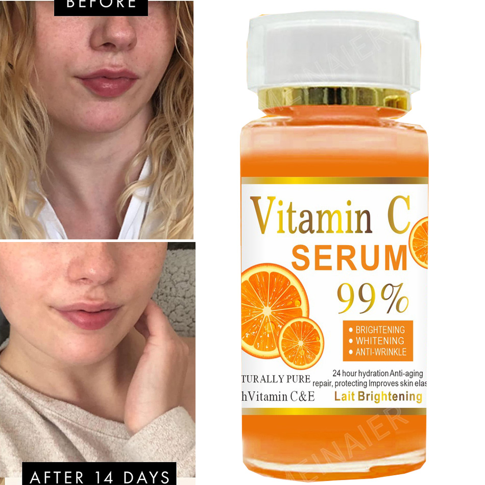 Vitamin C Serum - Super 120ml Vitamin C Serum Anti-aging