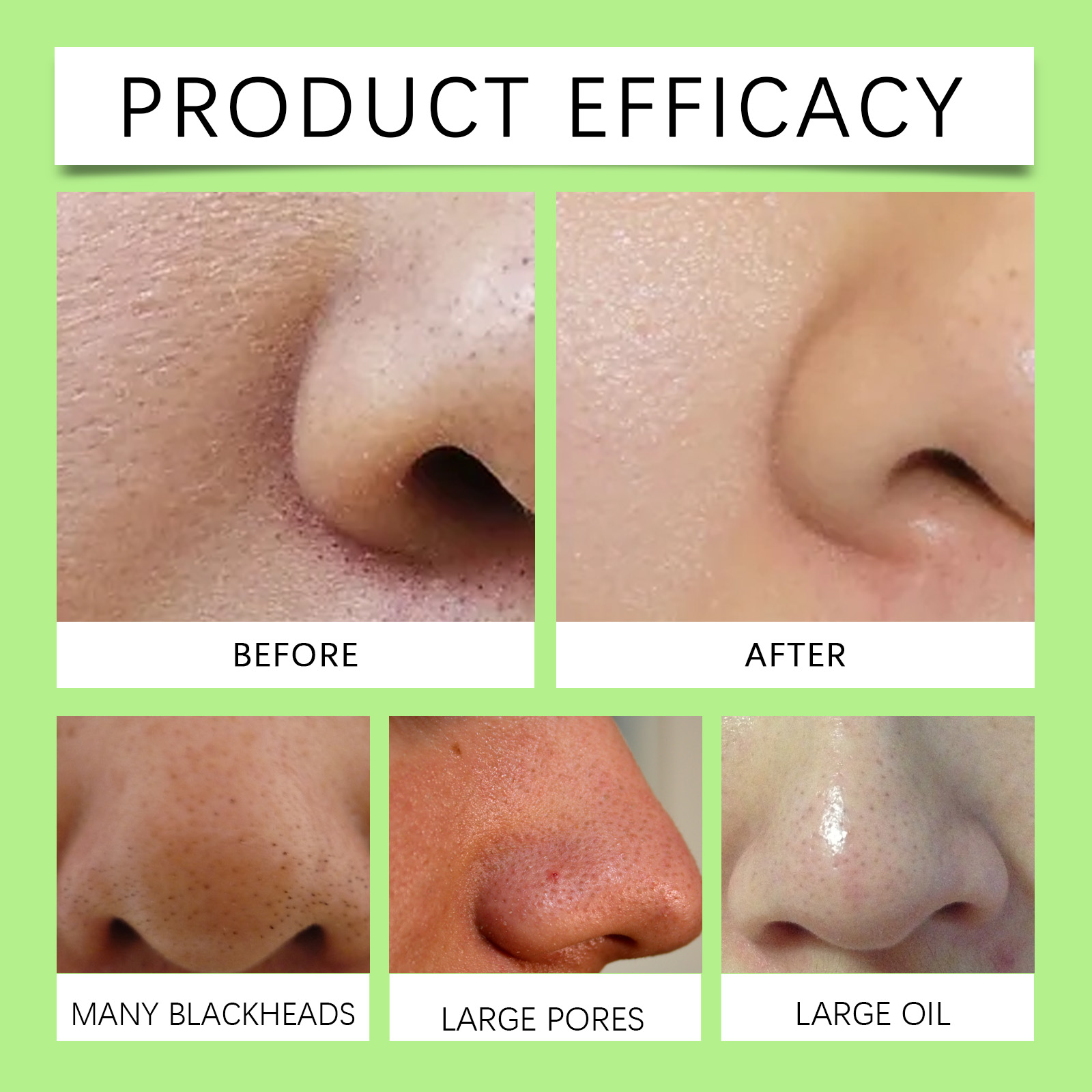 Bamboo Charcoal Nose Strips fo - Skincare China ulasan dan harga