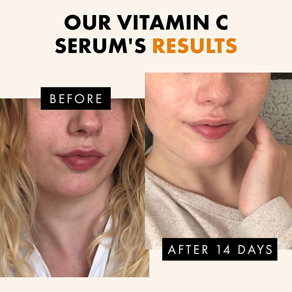 Super 120ml Vitamin C Serum An - Vitamin C Serum ulasan dan harga